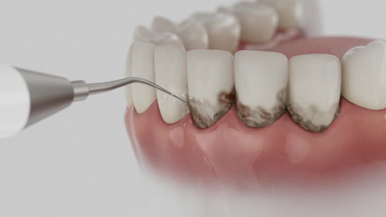 Reliable Dental Implants contractor in Trenton, MI by Smile Center Dentistry